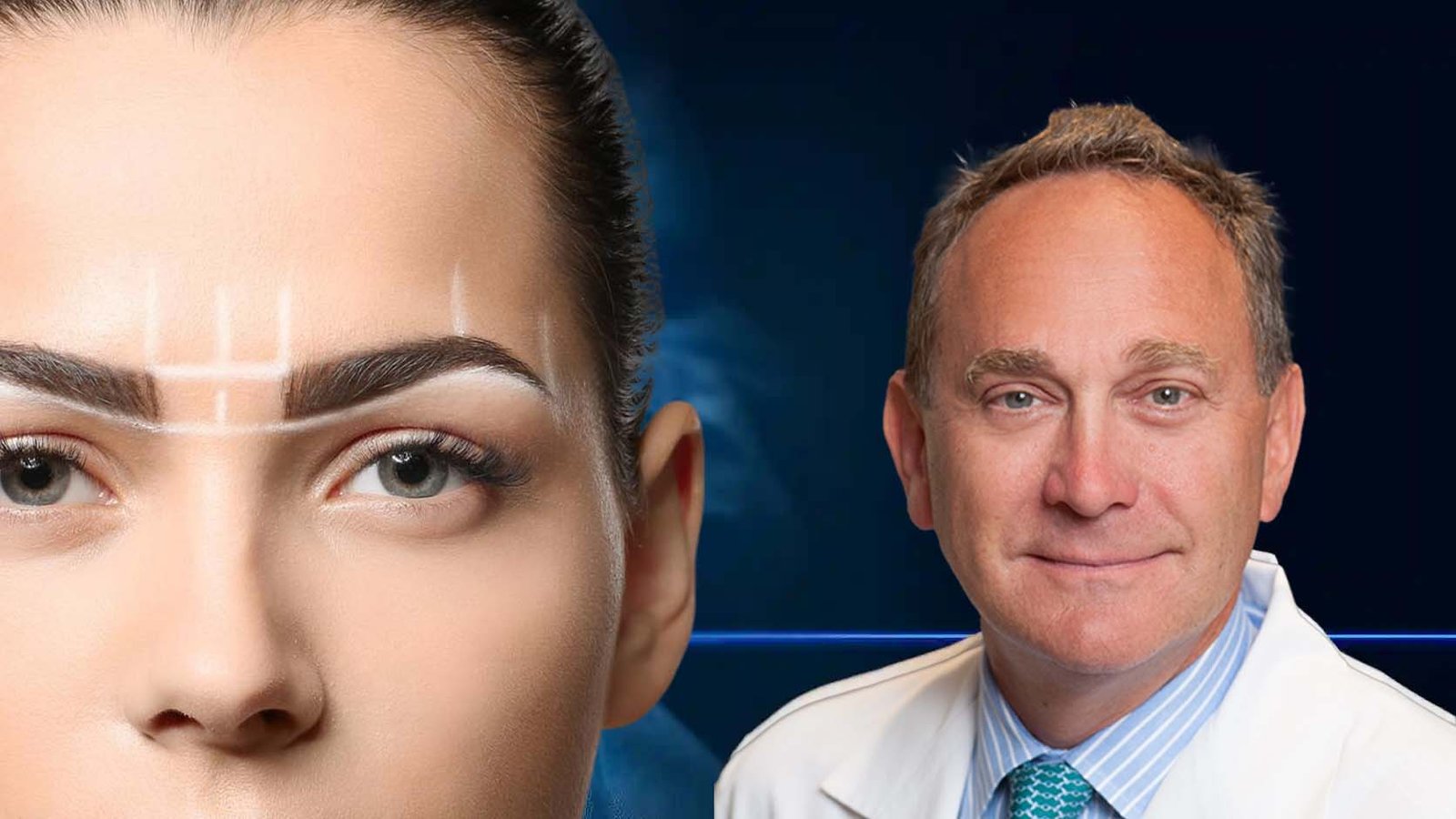 Key Maneuvers in Endoscopic Browlifting
