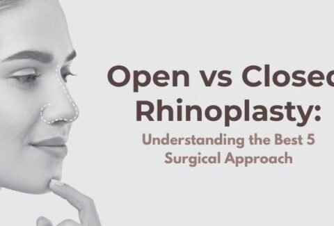 Open vs Closed Rhinoplasty: Understanding the Best 5 Surgical Approach